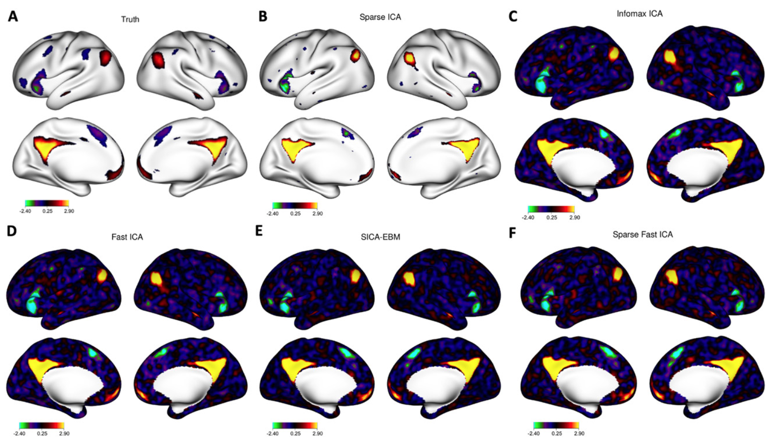 Sparse independent component analysis with an application to cortical surface fMRI data in autism